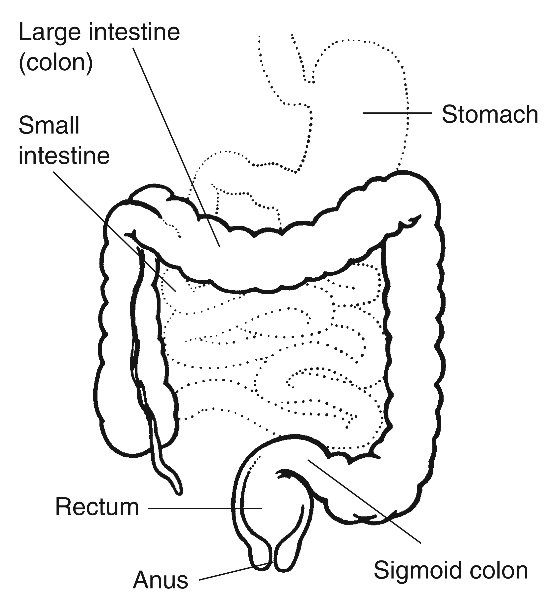 Medical illustration of the human digestive tract, including the colon, rectum and anus