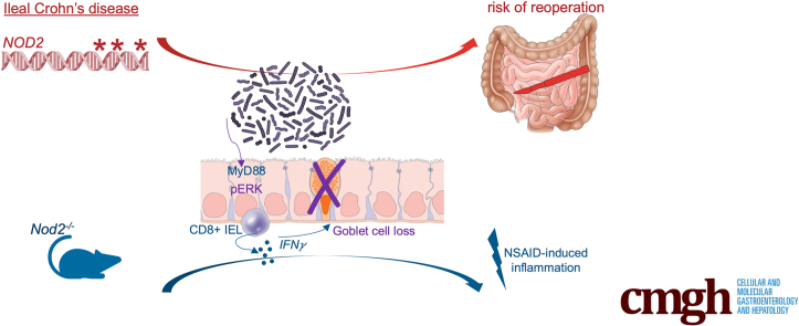 Graphical abstract summarising goblet cell loss linked to NOD2, dysbiosis and epithelial MyD88 in Crohn's disease